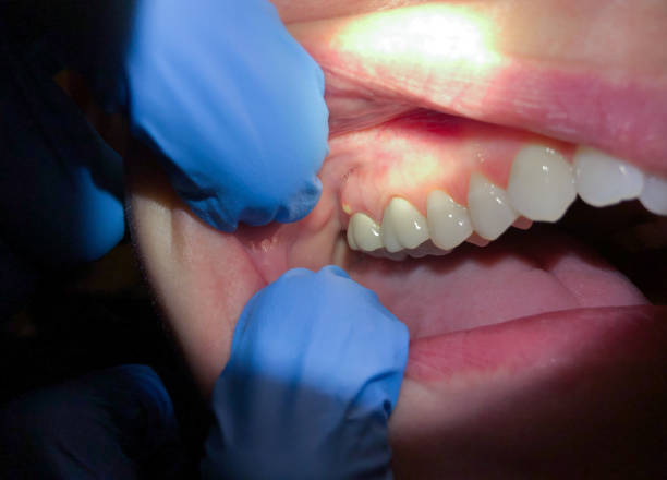 Best Cosmetic Emergency Dentistry in Hackensack, NJ