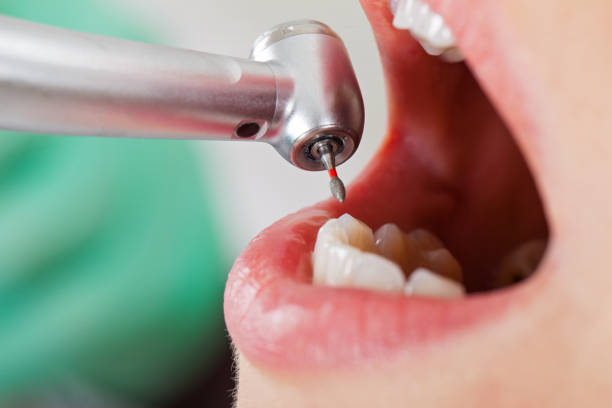 Best Emergency Treatment for Dental Infections or Abscesses in Hackensack, NJ